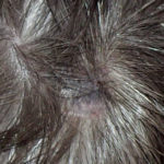 Mites at Guinea Pigs fur